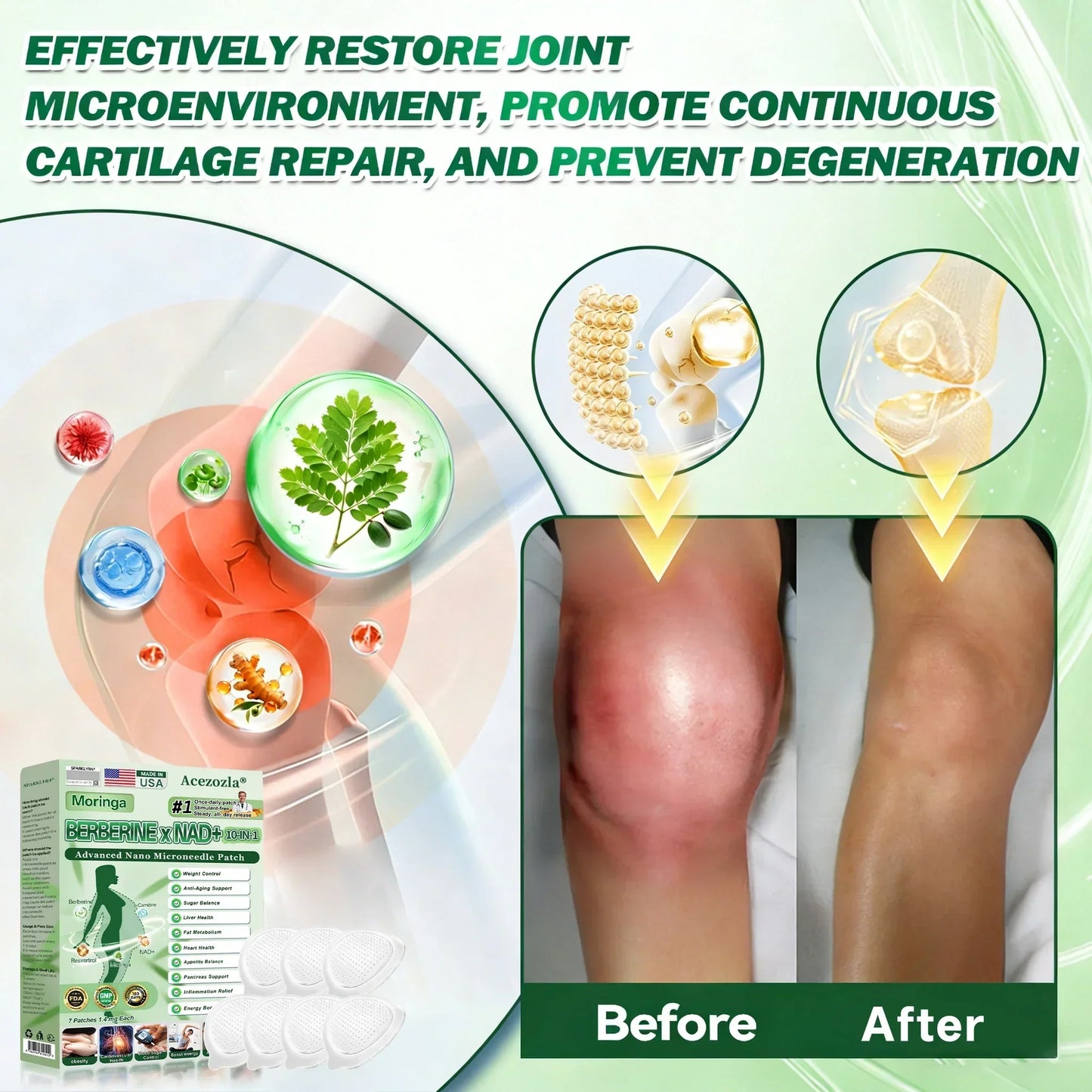 🇺🇸 𝐎𝐟𝐟𝐢𝐜𝐢𝐚𝐥 𝐔𝐒 𝐒𝐭𝐨𝐫𝐞 | 🧑‍⚕️🩺 Acezozla® Moringa · Berberine × NAD+ 𝟏𝟎-𝐢𝐧-𝟏 𝐀𝐝𝐯𝐚𝐧𝐜𝐞𝐝 𝐍𝐚𝐧𝐨 𝐌𝐢𝐜𝐫𝐨𝐧𝐞𝐞𝐝𝐥𝐞 𝐏𝐚𝐭𝐜𝐡 — 𝐎𝐧𝐜𝐞 𝐃𝐚𝐢𝐥𝐲, 𝐕𝐢𝐬𝐢𝐛𝐥𝐞 𝐑𝐞𝐬𝐮𝐥𝐭𝐬 𝐢𝐧 𝟕 𝐃𝐚𝐲𝐬🔥