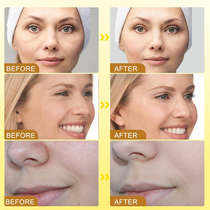 Bee Venom Botox Wrinkle Cream